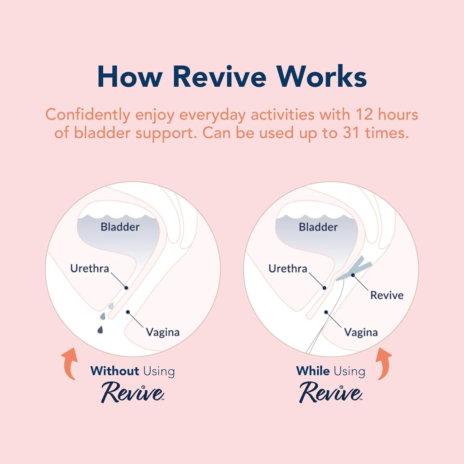 Revive Reusable Bladder Support Pessary for Women